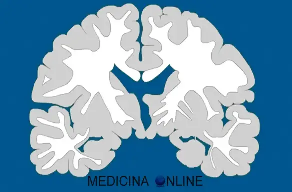 MEDICINA ONLINE FASCI DEL MIDOLLO SPINALE CORDONI COLONNA VERTEBRALE MIDOLLO SPINALE CERVELLO SISTEMA NERVOSO CENTRALE PERIFERICO SOSTANZA BIANCA GRIGIA ENCEFALO SNC SNP WHITE GRAY GREY MATTER