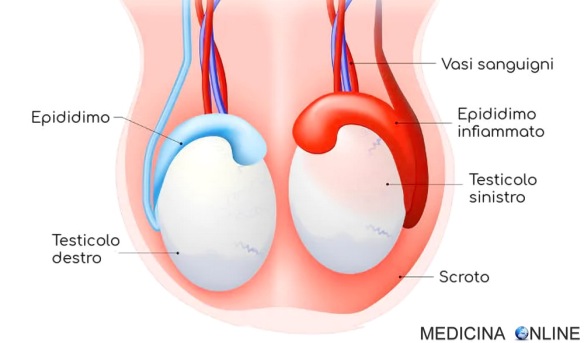MEDICINA ONLINE SCROTO TESTICOLO EPIDIDIMO EPIDIDIMITE INFIAMMAZIONE SESSO PENE EIACULAZIONE DOTTO DEFERENTE SACCO SCOTALE UOMO.jpg