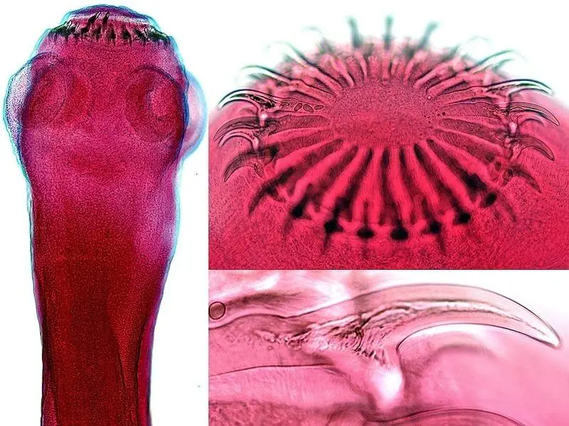 MEDICINA ONLINE TAENIA SOLIUM TENIA VERME SOLITARIO INTESTINO pork tapeworm infection