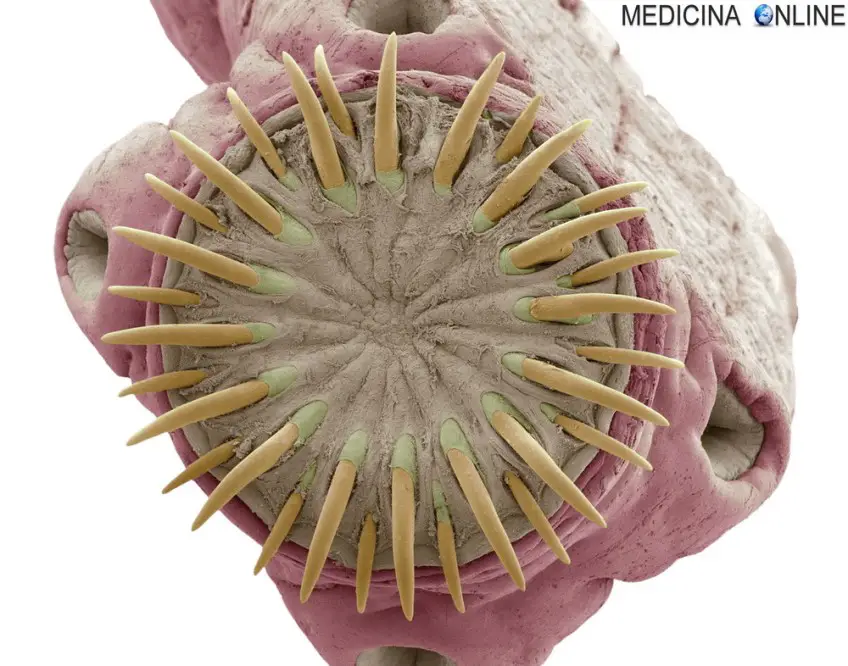 MEDICINA ONLINE TAENIA SOLIUM TENIA VERME SOLITARIO INTESTINO pork tapeworm infection