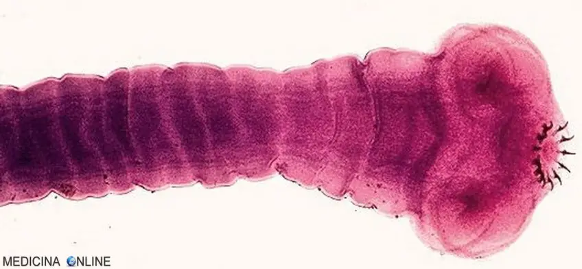 MEDICINA ONLINE TAENIA SOLIUM TENIA VERME SOLITARIO INTESTINO pork tapeworm infection