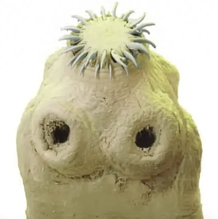 MEDICINA ONLINE TAENIA SOLIUM TENIA VERME SOLITARIO INTESTINO pork tapeworm infection