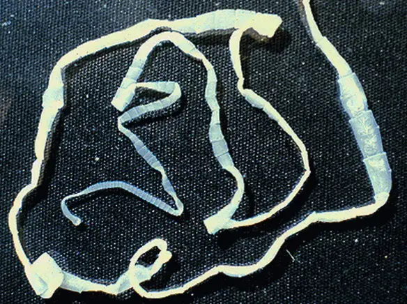 MEDICINA ONLINE TAENIA SOLIUM TENIA VERME SOLITARIO INTESTINO pork tapeworm infection