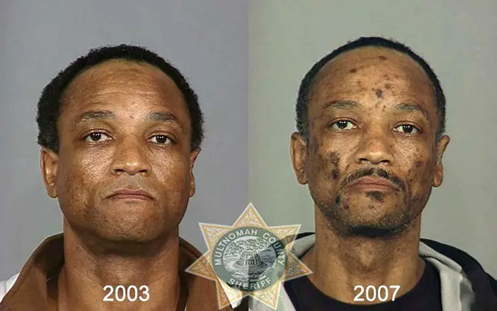 Come riconoscere un tossicodipendente eroinomane?