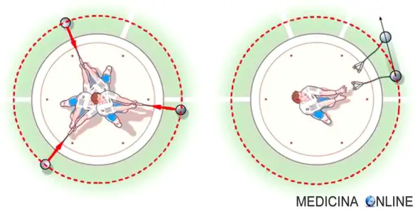 MEDICINA ONLINE DIFFERENZA TRA FORZA ACCELERAZIONE CENTRIFUGA CENTRIPEDA CERCHIO ORBITA MASSA VETTORE CENTRO RAGGIO DIAMETRO ESTERNO INTERNO DOVE FISICA MOVIMENTO.jpg