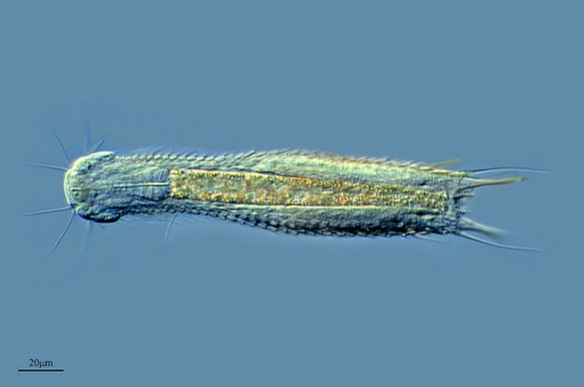 MEDICINA ONLINE Phylum Gastrotricha.jpg