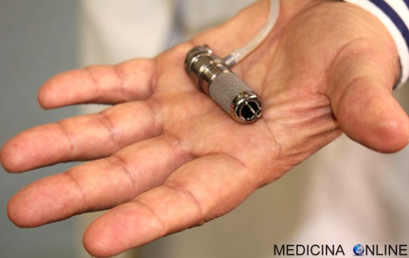 MEDICINA ONLINE MINI CUORE ARTIFICIALE BAMBINA 3 ANNI OSPEDALE BAMBINO GESU ROMA USA ITALIA TRAPIANTO SANGUE BERLIN HEART INFANT JARVIK 2015 National Institute of Health (NIH) PUMPKIN.jpg