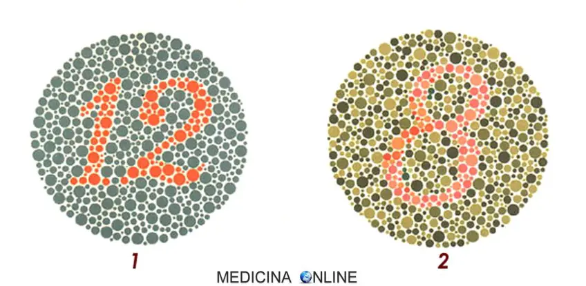 MEDICINA ONLINE Tavole di Ishihara Test Daltonismo Tavole