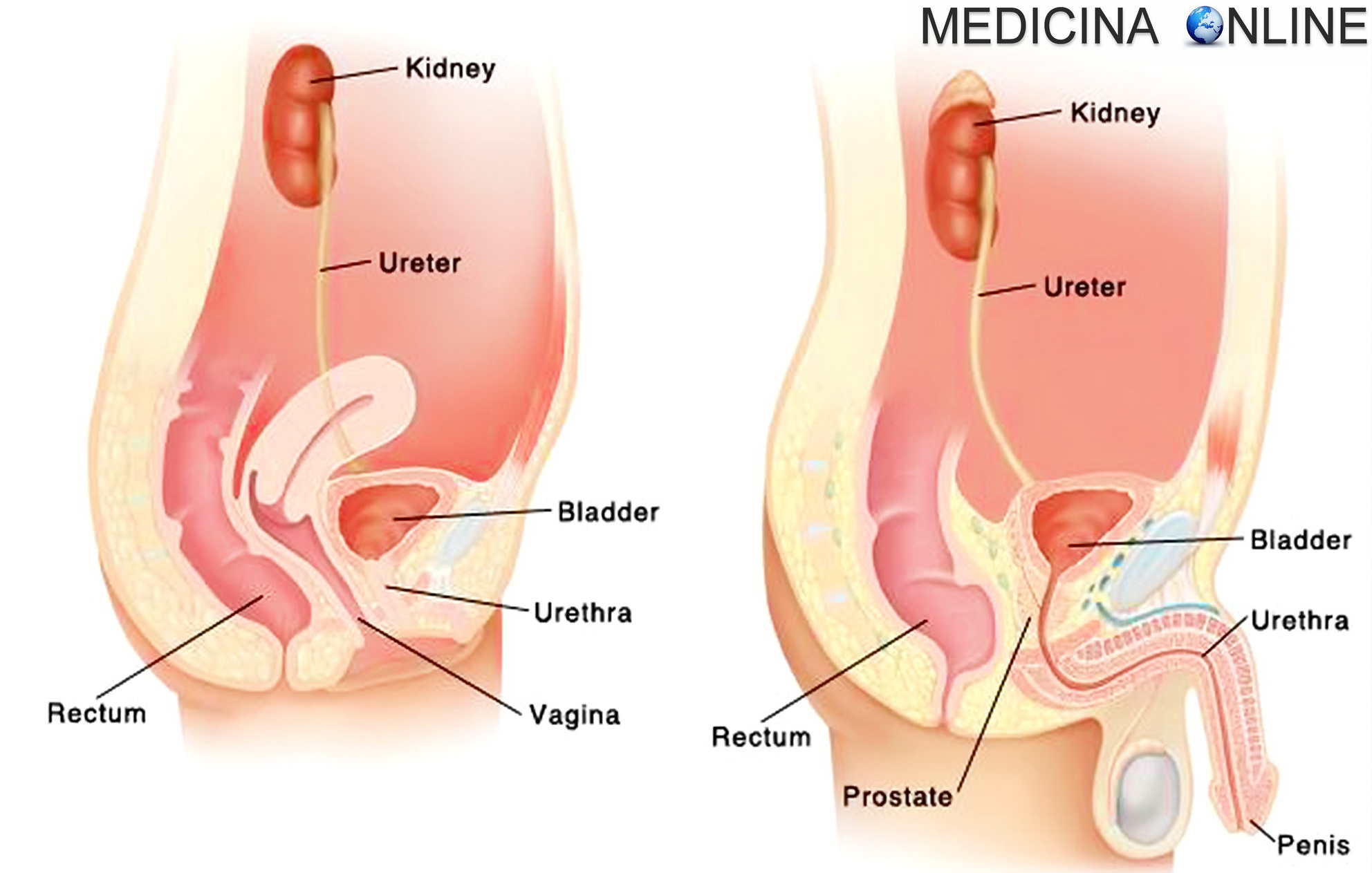 Incontinenza urinaria maschile e femminile: cause, tipi, da sforzo, rimedi  | MEDICINA ONLINE