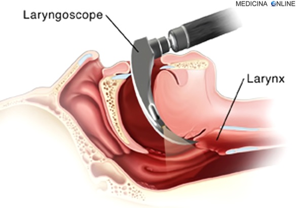 Side cut view of the head showing the nasal cavity, mouth, pharynx, and larynx. A rigid device called the laryngoscope is used to see to the larynx.