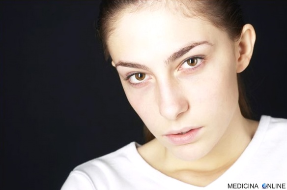 MEDICINA ONLINE PALLORE BIANCO VISO FACCIA VOLPO PELLE OCCHIAIE ANSIA STANCHEZZA ANEMIA SANGUE GLOBULO ROSSO BRUTTEZZA CAPILLARI FREDDO CIANOSI.jpg
