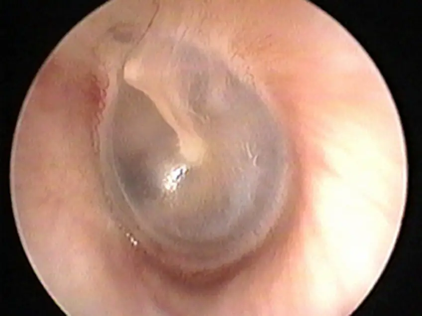 MEDICINA ONLINE OTOSCOPIA IMMAGINE