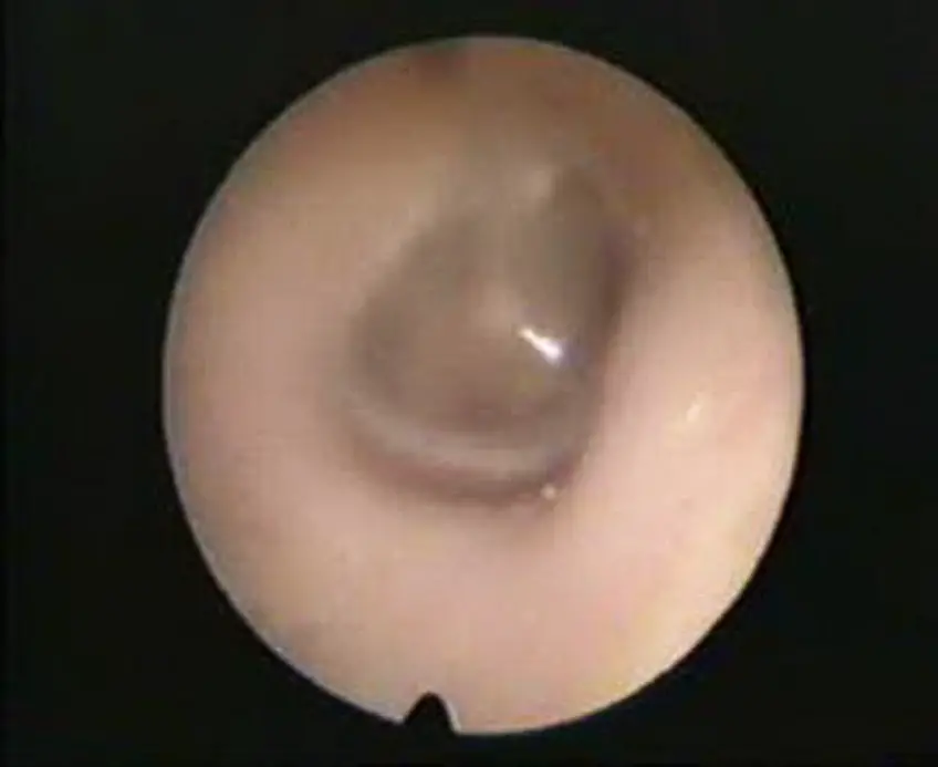 MEDICINA ONLINE OTOSCOPIA IMMAGINE