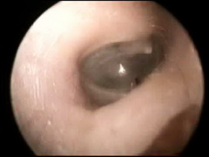 MEDICINA ONLINE OTOSCOPIA IMMAGINE