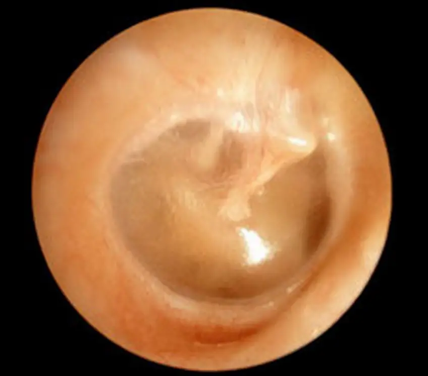 MEDICINA ONLINE OTOSCOPIA IMMAGINE