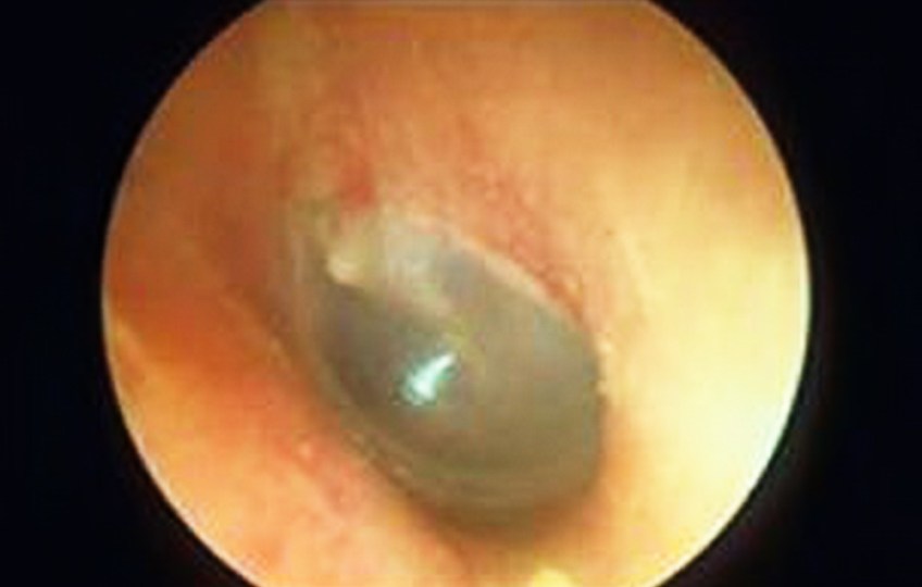 MEDICINA ONLINE OTOSCOPIA IMMAGINE