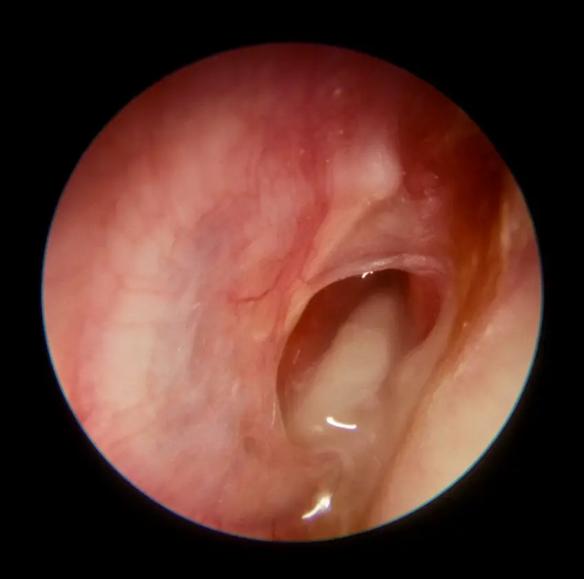 MEDICINA ONLINE OTOSCOPIA IMMAGINE