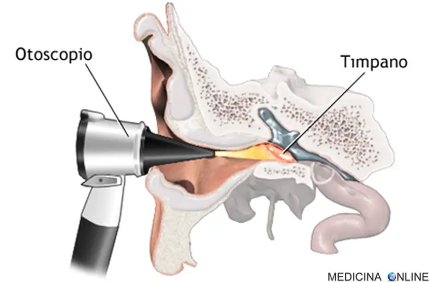MEDICINA ONLINE OTOSCOPIA OTOSCOPIO EQUILIBRIO OTOLITI ESAME VESTIBOLARE OTORINO VERTIGINI NISTAGMO ORECCHIO MOVIMENTI FASTIDIO CADUTA LABIRINTITE MENIERE OTOSCLEROSI DIAGNOSI COSTO SEMICIRCOLARE LABIRINTO