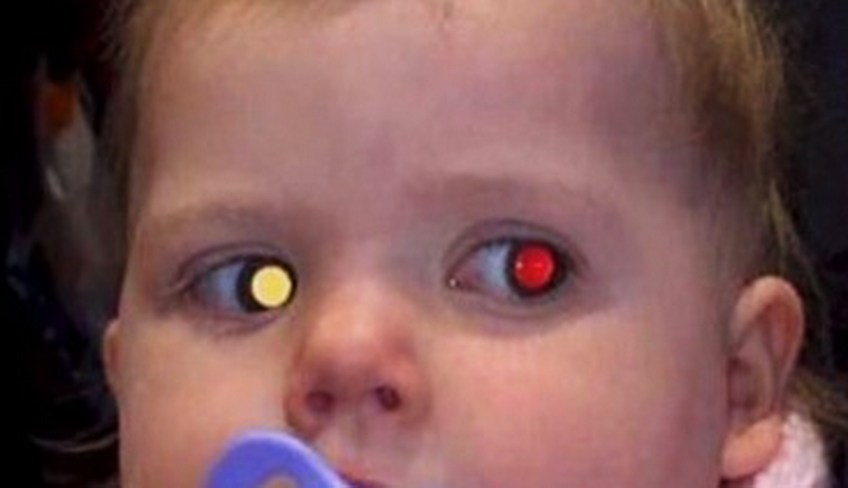 MEDICINA ONLINE TUMORE CANCRO OCCHIO IMMAGINE