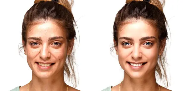 MEDICINA ONLINE BEFORE AFTER FACETUNE PHOTOSHOP.jpg