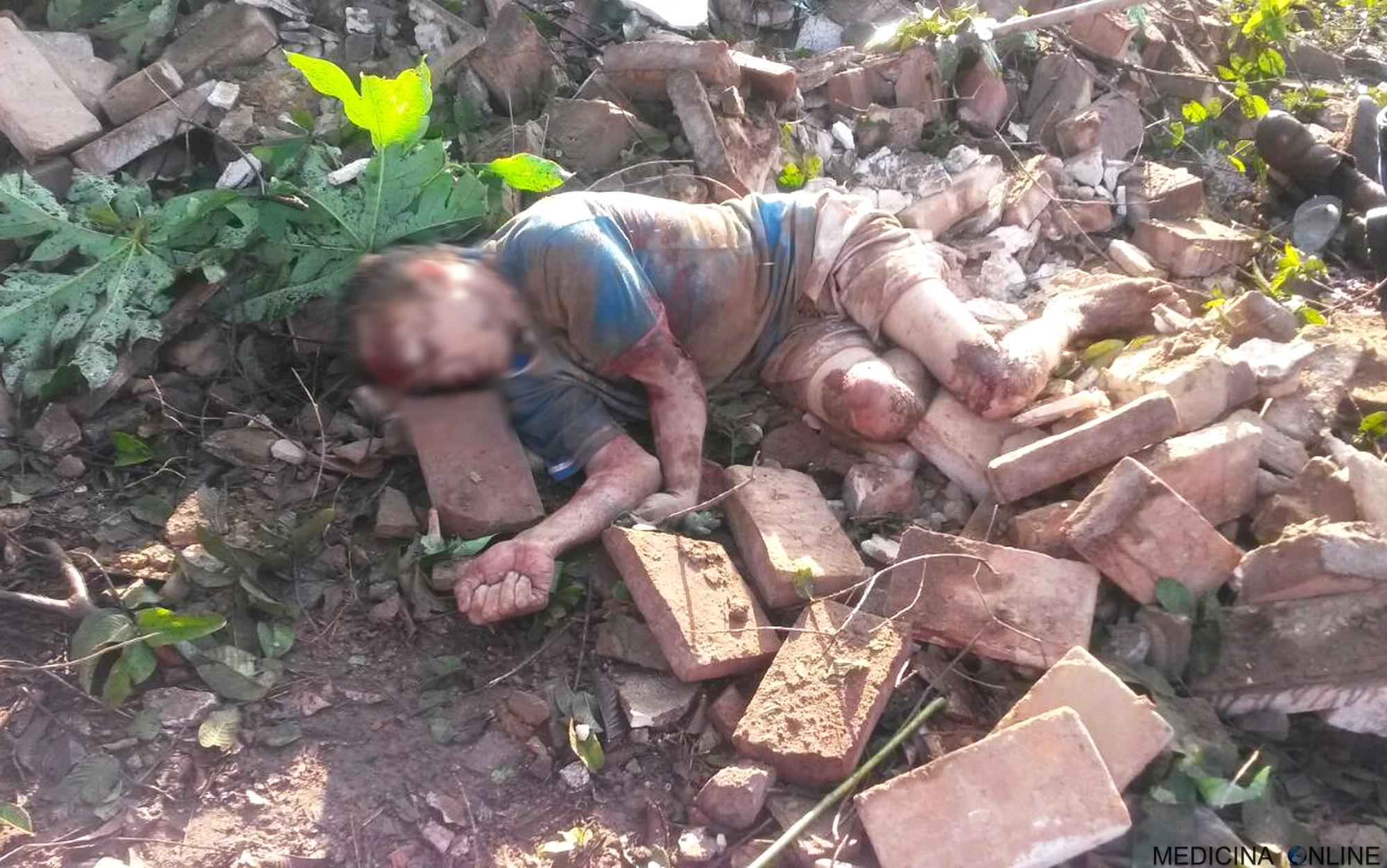 MEDICINA ONLINE MORTE PER ESPLOSIONE CROLLO DI PALAZZO EDIFICIO APPARTAMENTO ESPLODE GAS BOILER EXPLOSION DAMAGE DEATH DEAD BODIES PIC IMAGE PICTURE.jpg