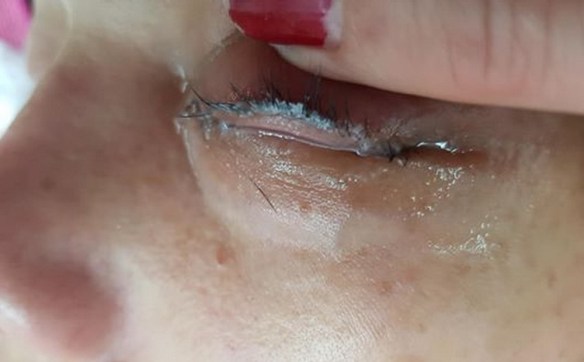 MEDICINA ONLINE SALONE DI BELLEZZA ESTENSIONI CIGLIA SOPRACCIGLIA DANNO BELLA ESTETICA VISO BRUTTO PALPEBRA ESTETISTA.jpg