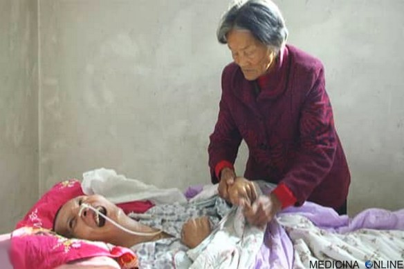 MEDICINA ONLINE Wang Shubao MOTHER Wei Mingying CINA Si sveglia dopo 12 anni di coma la madre 75enne lo ha accudito giorno e notte.jpg