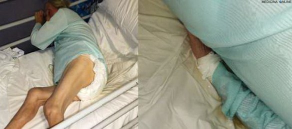 MEDICINA ONLINE Anziana legata in ospedale ritrovata agitata ed impregnata di urine e sangue.jpg