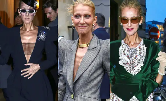 MEDICINA ONLINE Celine Dion è troppo magra soffre di anoressia Lei risponde Lasciatemi in pace