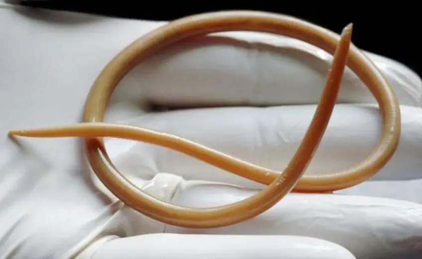 MEDICINA ONLINE ASCARIDI IMMAGINI