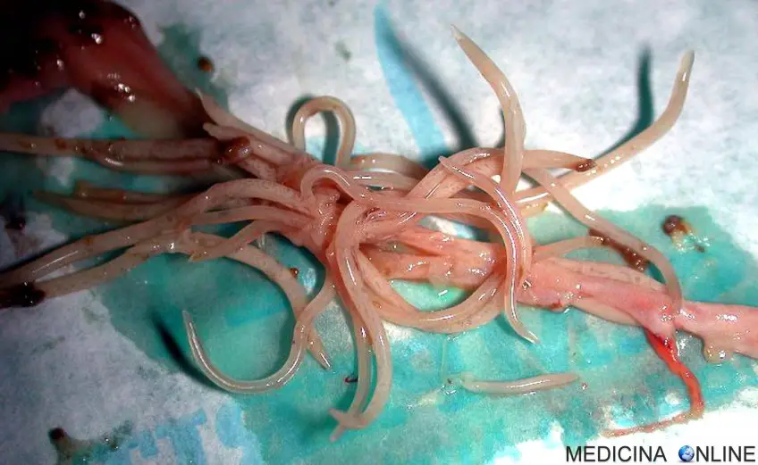 MEDICINA ONLINE ASCARIDI PARASSITI INTESTINALI VERMI FECI COLON ANO UOVA COME ELIMINARE CONTAGIO TRASMISSIONE INFEZIONE PARASSITOSI BAMBINI BIMBI ADULTI ASCARIDIASI ASCARIDOSI IMMAGINI ASCARIS LUMBRICOIDES