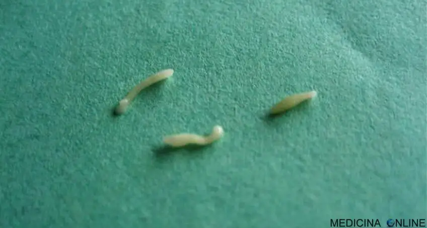 MEDICINA ONLINE OSSIURI VERMI INTESTINALI IMMAGINE 1