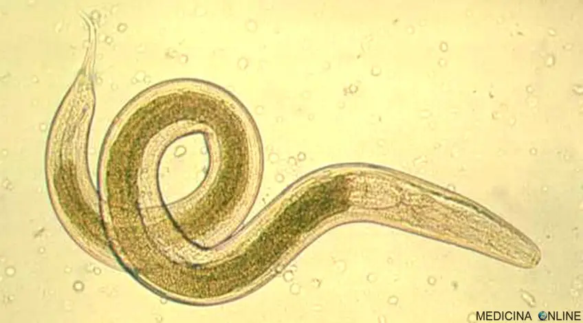 MEDICINA ONLINE OSSIURI VERMI INTESTINALI IMMAGINE