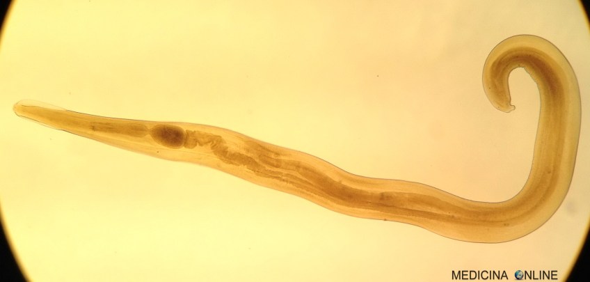 MEDICINA ONLINE OSSIURI VERMI INTESTINALI IMMAGINE
