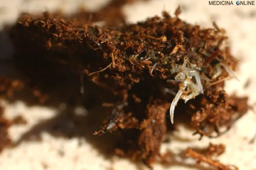 MEDICINA ONLINE OSSIURI VERMI INTESTINALI IMMAGINE