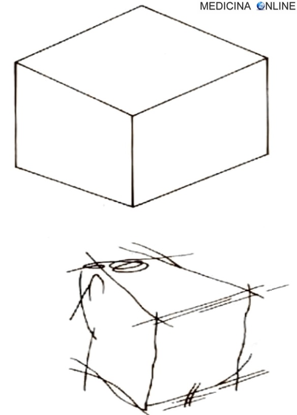 MEDICINA ONLINE APRASSIA COSTRUTTIVA DISEGNO DIAGNOSI.jpg