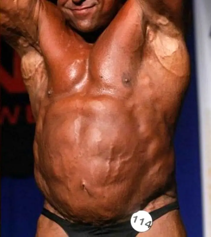 MEDICINA ONLINE BUBBLE GUT ADDOME GH DOPING IMMAGINE.