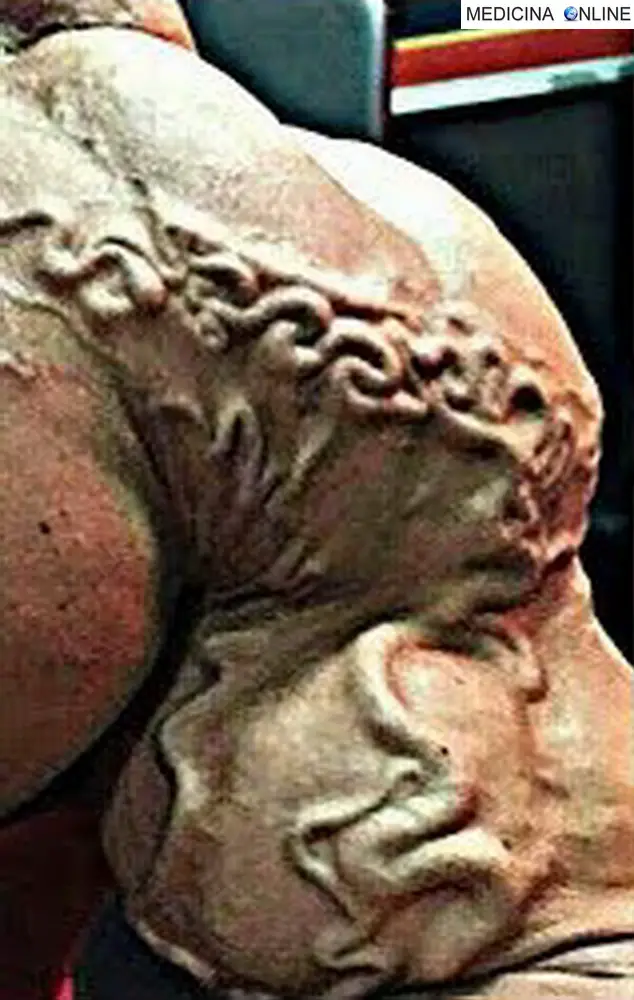 MEDICINA ONLINE DOPING BODYDUILDING VASCOLARIZZAZIONE IMMAGINE.