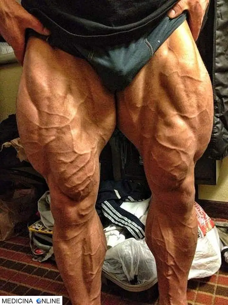 MEDICINA ONLINE DOPING BODYDUILDING VASCOLARIZZAZIONE IMMAGINE.