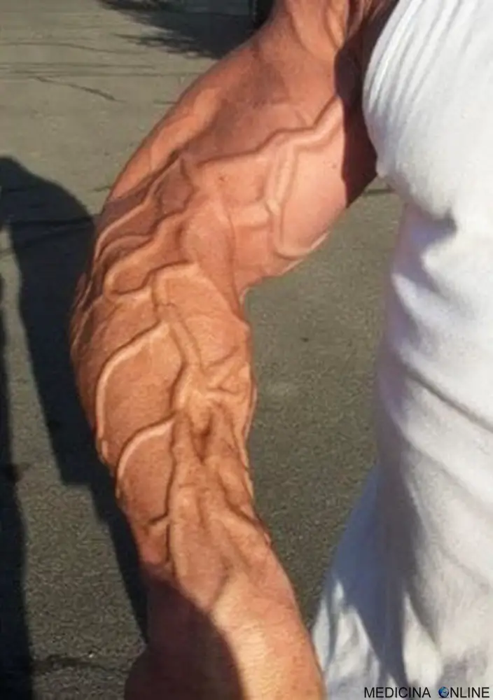 MEDICINA ONLINE DOPING BODYDUILDING VASCOLARIZZAZIONE IMMAGINE