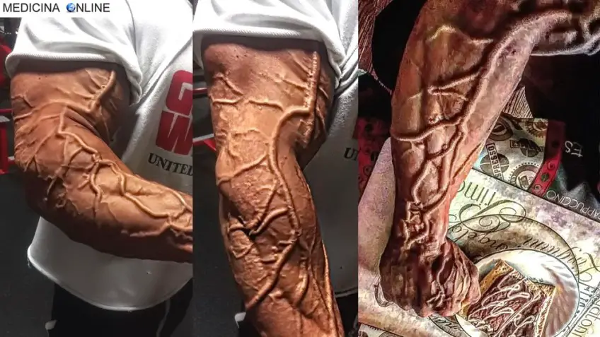 MEDICINA ONLINE DOPING BODYDUILDING VASCOLARIZZAZIONE IMMAGINE.