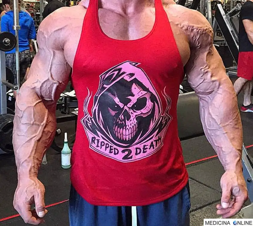 MEDICINA ONLINE DOPING BODYDUILDING VASCOLARIZZAZIONE IMMAGINE.