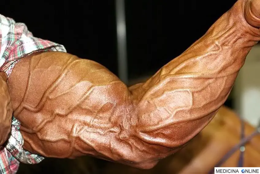 MEDICINA ONLINE DOPING BODYDUILDING VASCOLARIZZAZIONE IMMAGINE.