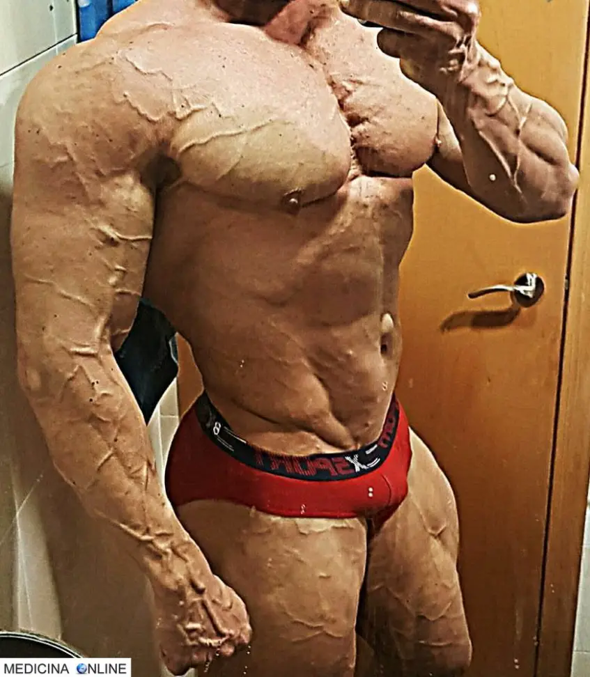 MEDICINA ONLINE DOPING BODYDUILDING VASCOLARIZZAZIONE IMMAGINE.