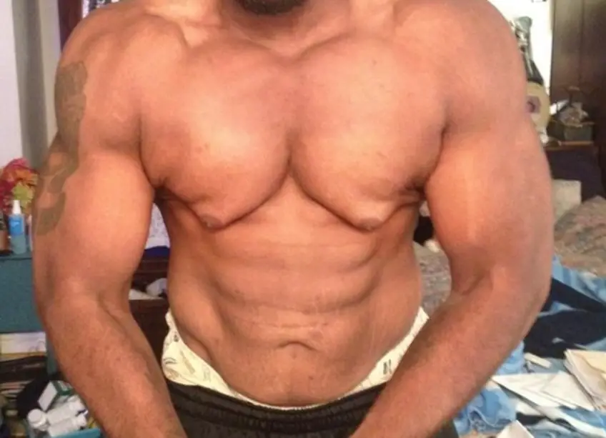 MEDICINA ONLINE GINECOMASTIA DOPING BODY BUILDING IMMAGINE.