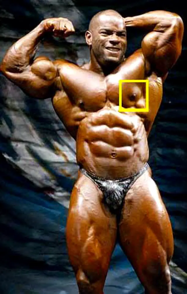 MEDICINA ONLINE GINECOMASTIA DOPING BODY BUILDING IMMAGINE.