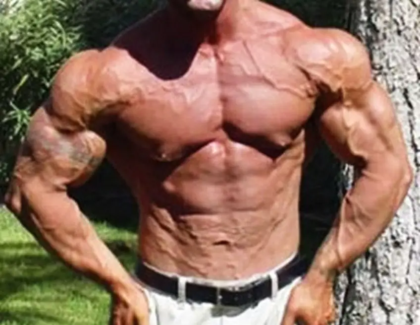 MEDICINA ONLINE DOPING BODYDUILDING VASCOLARIZZAZIONE IMMAGINE.