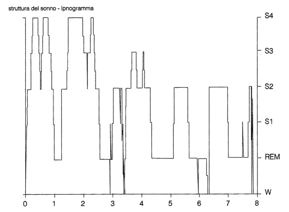 MEDICINA ONLINE SONNO DORMIRE POLISONNO GRAFIA Ipnogramma di una notte di sonno in un soggetto giovane, sano, ben adattato alle condizioni di registrazioni poligrafiche.jpg