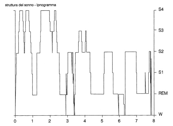 MEDICINA ONLINE SONNO DORMIRE POLISONNO GRAFIA Ipnogramma di una notte di sonno in un soggetto giovane, sano, ben adattato alle condizioni di registrazioni poligrafiche