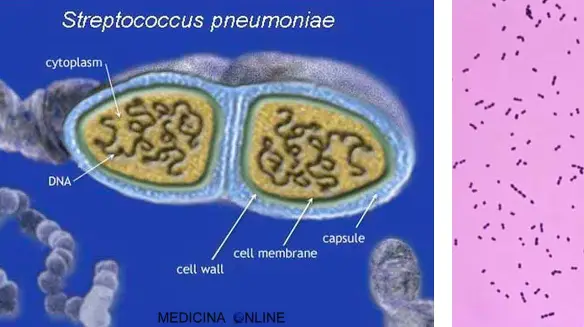 DOTT. EMILIO ALESSIO LOIACONO MEDICO CHIRURGO MEDICINA ONLINE BATTERIO PNEUMOCOCCO STREPTOCOCCO PNEUMONIAE LABORATORIO RICERCA SCIENZIATO MICROSCOPIO VETRINO BIOLOGIA MICROBIOLOGIA VIRUS LABORATORY